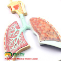 LUNG06 (12503) Human Respiratory Section Abschnitt Modell, Anatomie Modelle&gt; Atmung